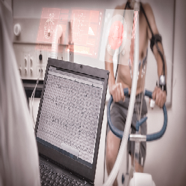 Treadmill stress test