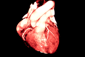 Ct Coronary Angiogram